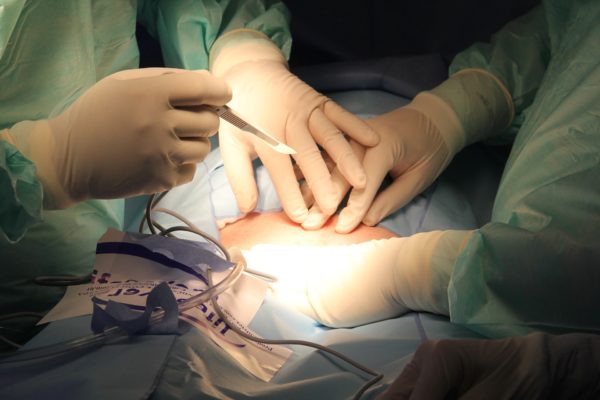 Achilles Surgery: Is It Right For You?
