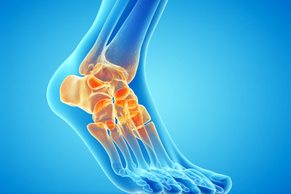 Faster Recovery with Ankle Scoping