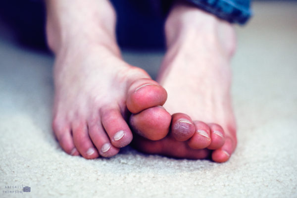 Prevent Frostbite on Feet & Toes